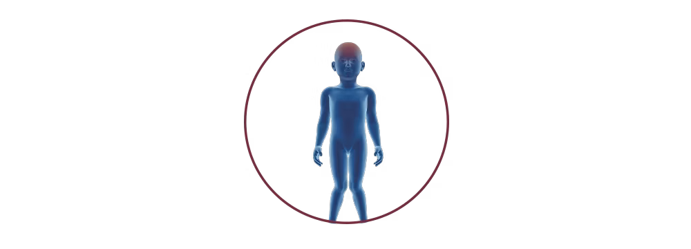 STIWELL® | functional electrical stimulation (FES) for cerebral palsy STIWELL® | functional electrical stimulation (FES) for cerebral palsy