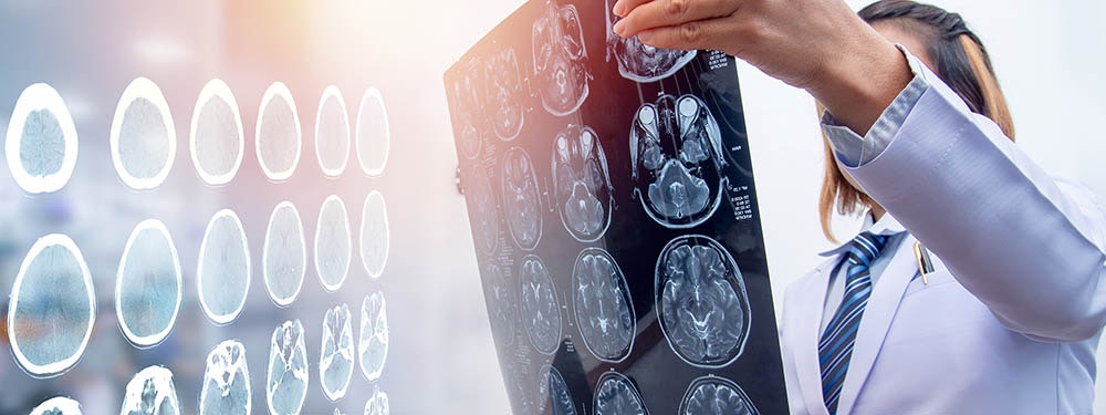 Diagnosis of traumatic brain injury Diagnosis of traumatic brain injury