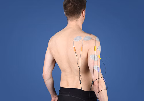 STIWELL therapy | brachial plexus injury STIWELL therapy | brachial plexus injury