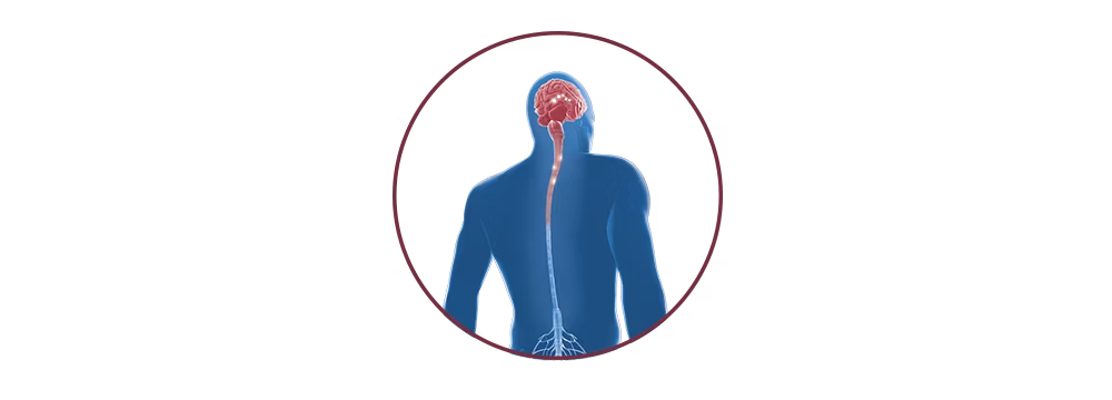 STIWELL® | functional electrical stimulation (FES) for multiple sclerosis STIWELL® | functional electrical stimulation (FES) for multiple sclerosis
