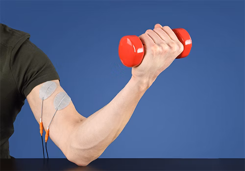 Elektrotherapie bei muskulärer Dysbalance Elektrotherapie bei muskulärer Dysbalance