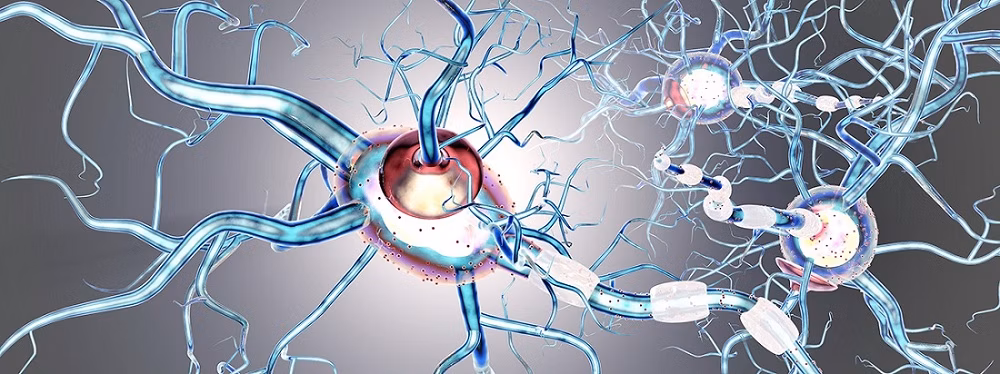 What is multiple sclerosis? What is multiple sclerosis?