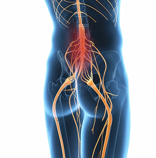 Symptoms of tetraplegia