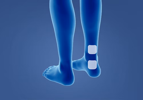 STIWELL® Therapie | Überaktive Blase STIWELL® Therapie | Überaktive Blase