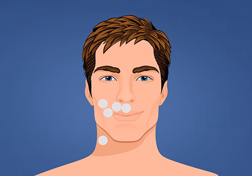 STIWELL therapy | activation of mouth movement STIWELL therapy | activation of mouth movement