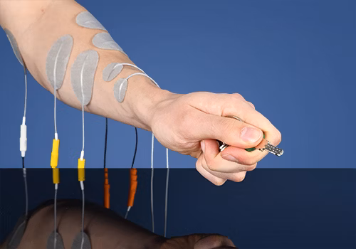 STIWELL Therapie | Schlüsselgriff (EMG) STIWELL Therapie | Schlüsselgriff (EMG)