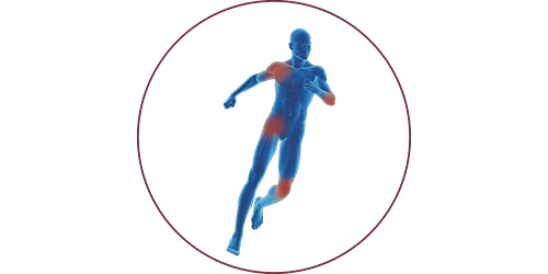 FES for orthopaedics & traumatology | STIWELL® Neurorehabilitation