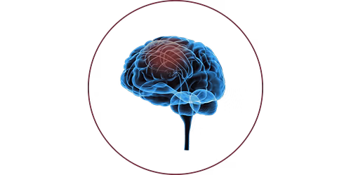 FES nach Schlaganfall | STIWELL® Neurorehabilitation