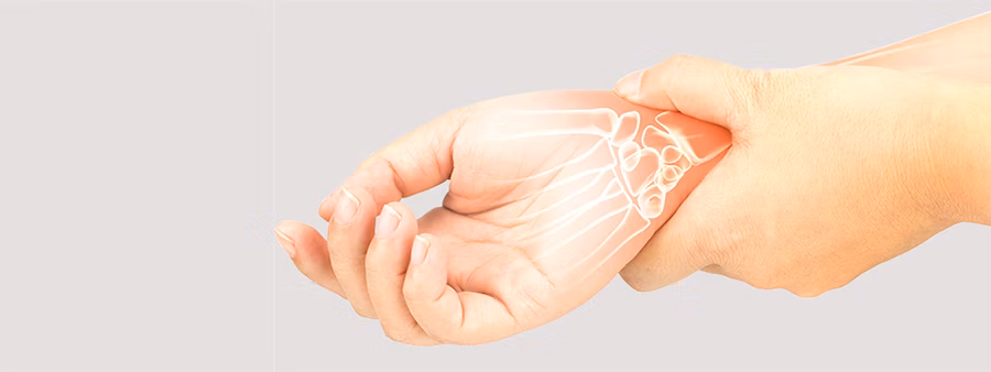 Causes of carpal tunnel syndrome Causes of carpal tunnel syndrome