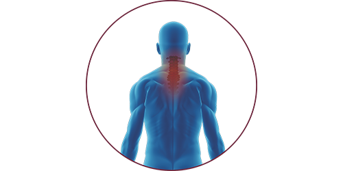 FES bei Tetraplegie | STIWELL® Neurorehabilitation
