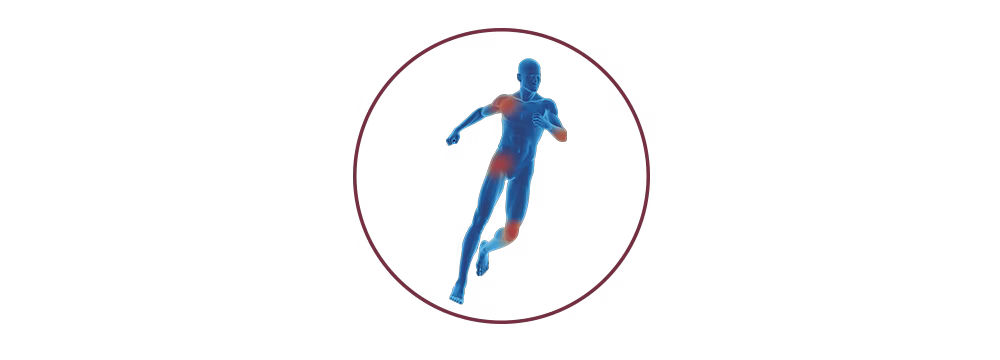 STIWELL® | functional electrical stimulation (FES) for orthopaedics & traumatology STIWELL® | functional electrical stimulation (FES) for orthopaedics & traumatology