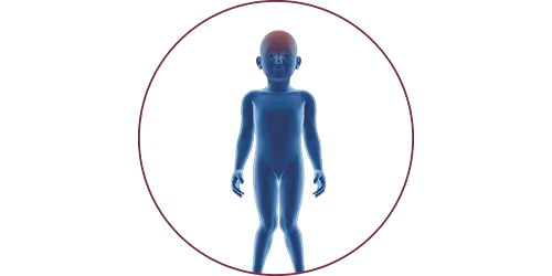 FES bei Zerebralparese | STIWELL® Neurorehabilitation