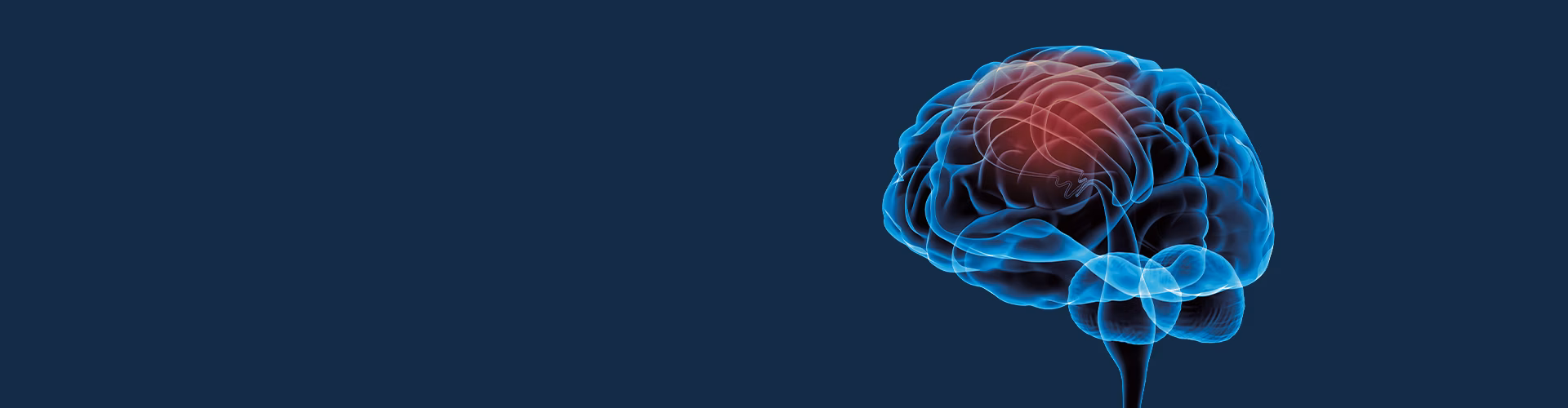 STIWELL Neurorehabilitation | Anwendungen in der Neurologie