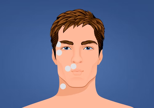 STIWELL Therapie | Lippen spitzen - Augen entspannt (EMG) STIWELL Therapie | Lippen spitzen - Augen entspannt (EMG)