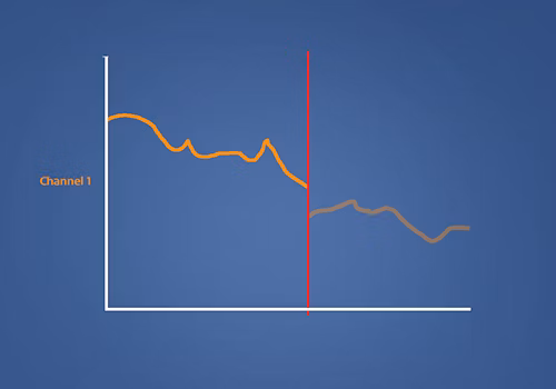 STIWELL Therapie | Muskelaktivitätsanalyse (EMG) STIWELL Therapie | Muskelaktivitätsanalyse (EMG)
