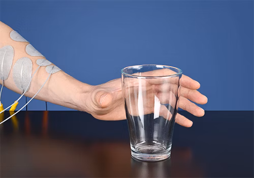Multiple Sklerose Therapie mit Elektrostimulation