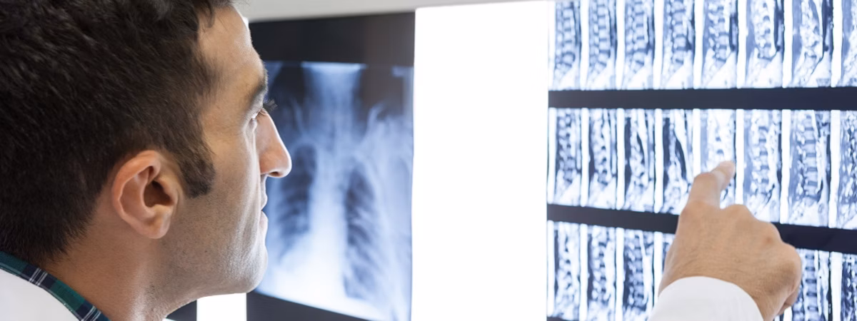 Diagnosis of a herniated disc Diagnosis of a herniated disc