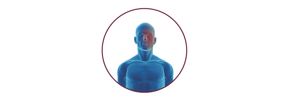 STIWELL® | Functional electrical stimulation (FES) for facial nerve palsy STIWELL® | Functional electrical stimulation (FES) for facial nerve palsy