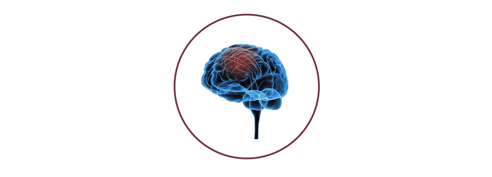 STIWELL® | Functional electrical stimulation (FES) after stroke STIWELL® | Functional electrical stimulation (FES) after stroke