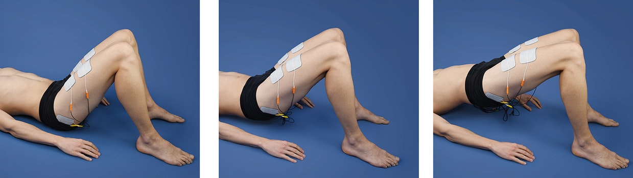 Rehabilitation for hip arthrosis Rehabilitation for hip arthrosis