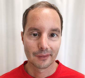 STIWELL Neurorehabilitation | Erfahrungsbericht: Gesichtslähmung STIWELL Neurorehabilitation | Erfahrungsbericht: Gesichtslähmung